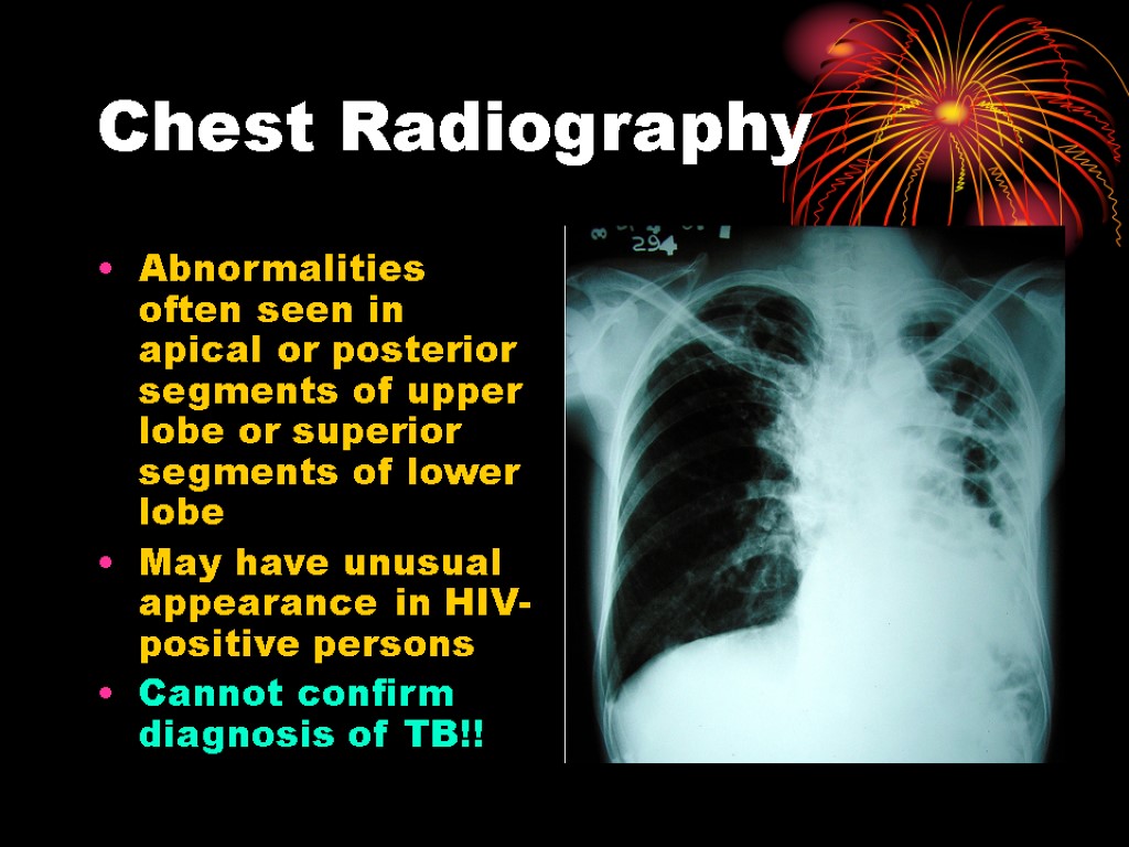 Chest Radiography Abnormalities often seen in apical or posterior segments of upper lobe or